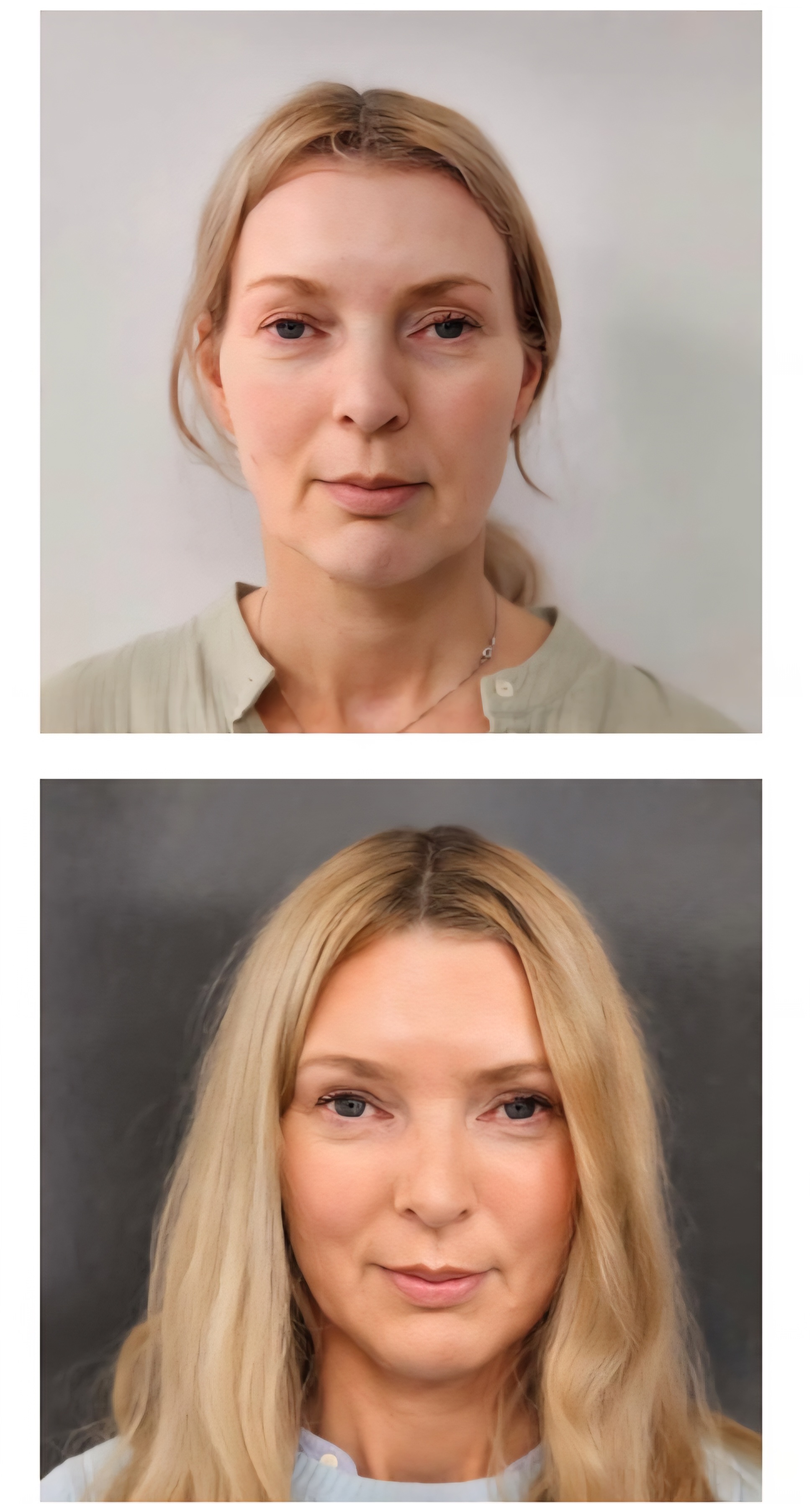 Treatment result